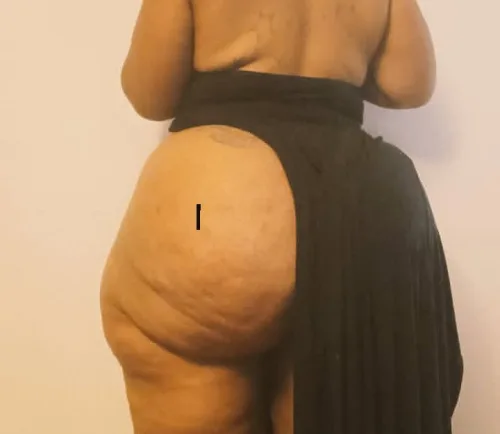 Linda — 2