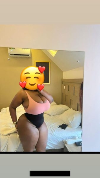 Massive Breast — 2
